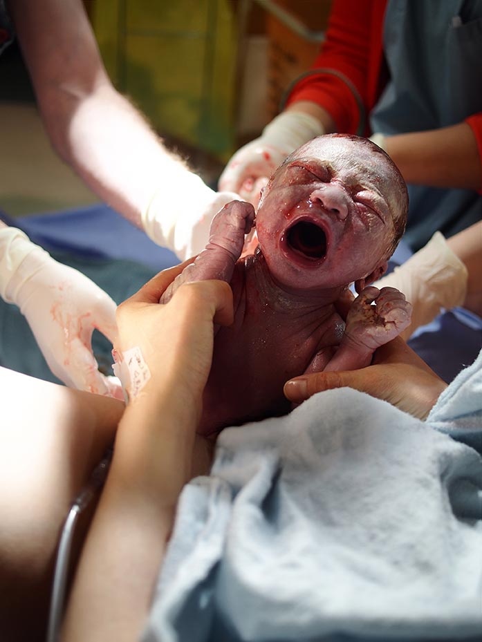 Newborn baby delivered by your obstetrician