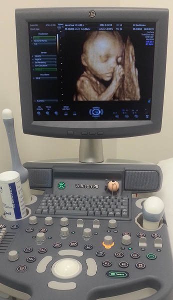 4D Ultrasound Scanner for antenatal visits