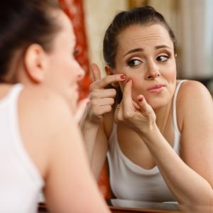 Acne can affect women with PCOS