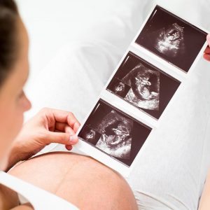 Early pregnancy ultrasound can be useful for dating the pregnancy and working out the due date of the pregnancy