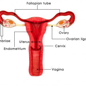 Endometriosis can vary in location within and outside the female pelvis